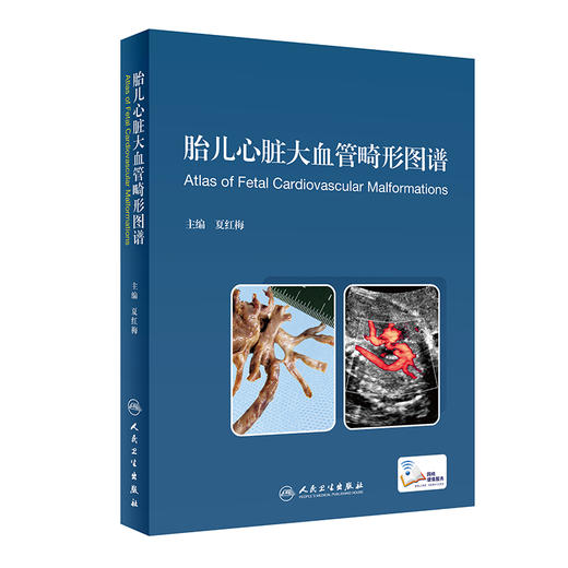 胎儿心脏大血管畸形图谱 9787117297097 商品图0