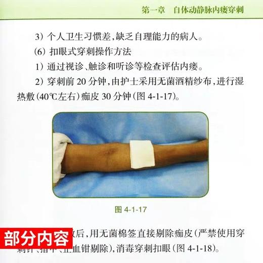 血液透析用血管通路护理操作指南 人卫出版 商品图3