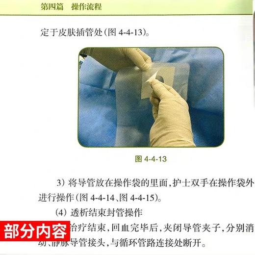血液透析用血管通路护理操作指南 人卫出版 商品图2