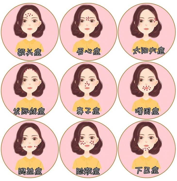 9种痘肌.jpg