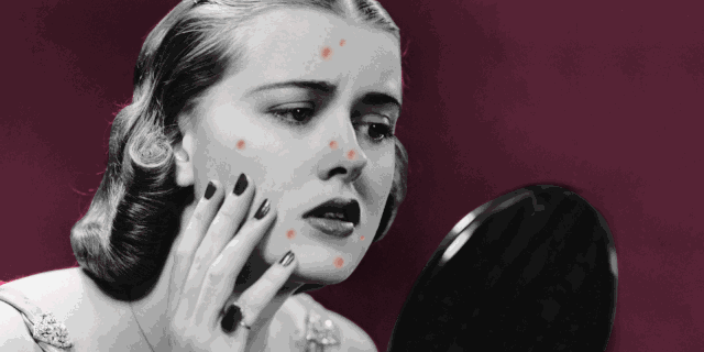 如果你还觉得,祛痘就只是把痘痘消灭了,把痘印消除了就完事了,那你就