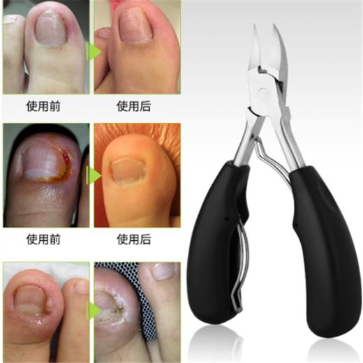 【甲沟炎克星，无痛修剪】专用甲沟鹰嘴钳，可深入剪掉甲沟嵌甲，方便清理，拒绝指甲长到肉里 商品图1