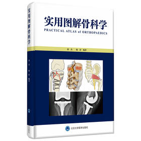 实用图解骨科学 刘杰 杨舒 编著