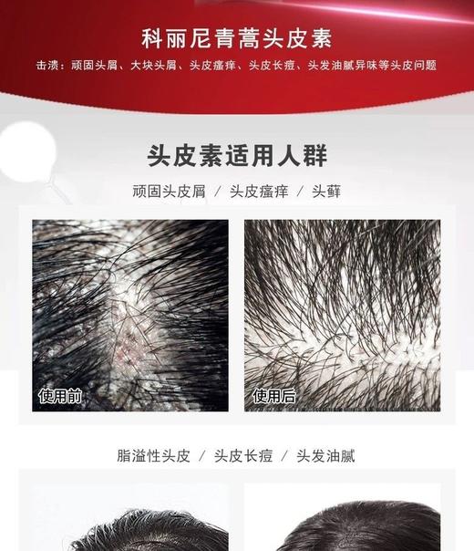 科丽尼青蒿头皮素128m(洗发水) 商品图2