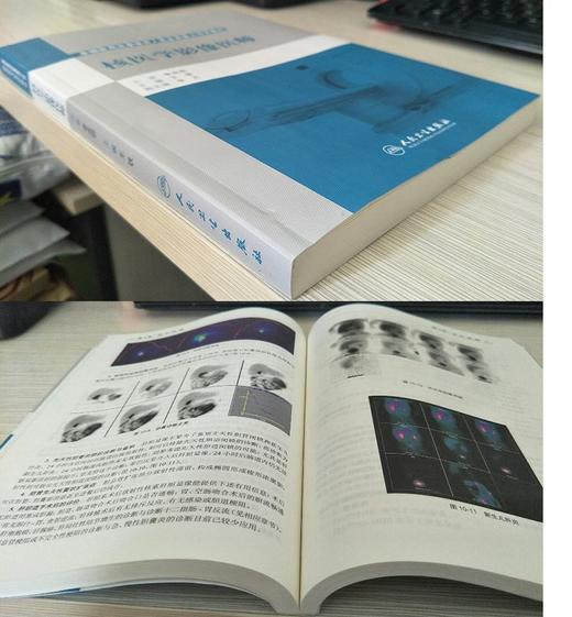 核医学影像医师2019年全国大型医用医疗设备使用人员业务能力技师考评教材上岗证考试书器械仪器书籍人民卫生出版社彩超核磁磁共振 商品图3