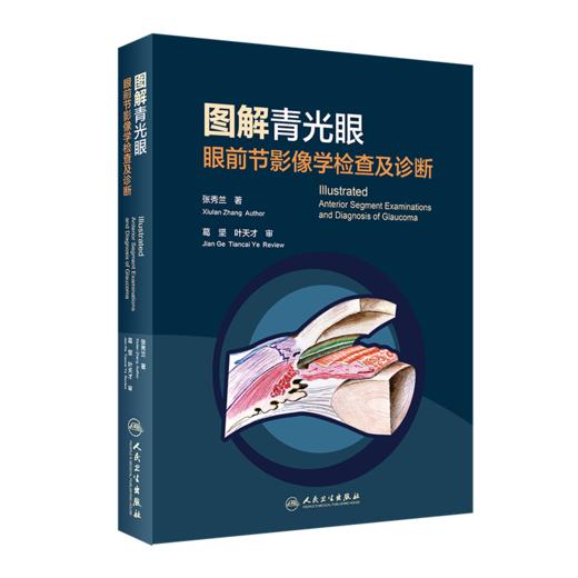 图解青光眼   眼前节影像学检查及诊断 商品图0