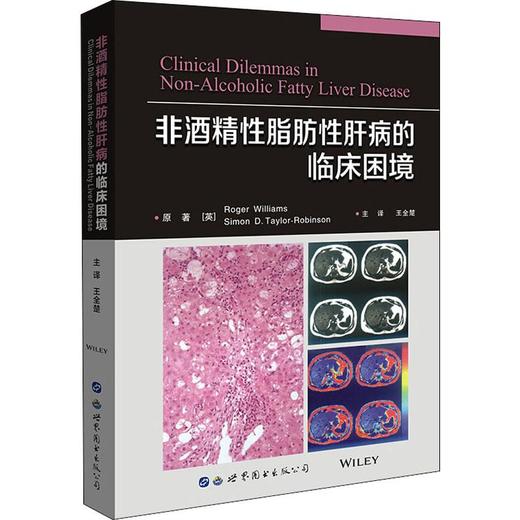 非酒精性脂肪性肝病的临床困境 商品图0