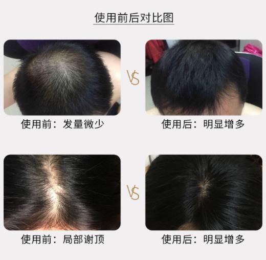 何首乌养护黑发皂（新旧包装随机发货） 商品图1