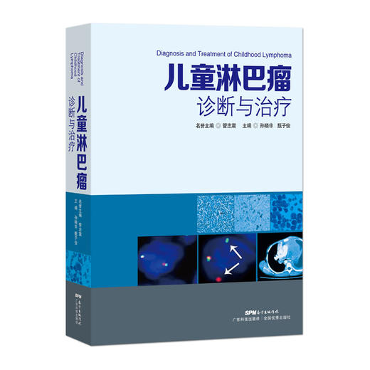 儿童淋巴瘤诊断与治 商品图0