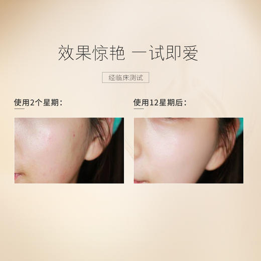 雅顿金胶面部胶囊精华新版 商品图5
