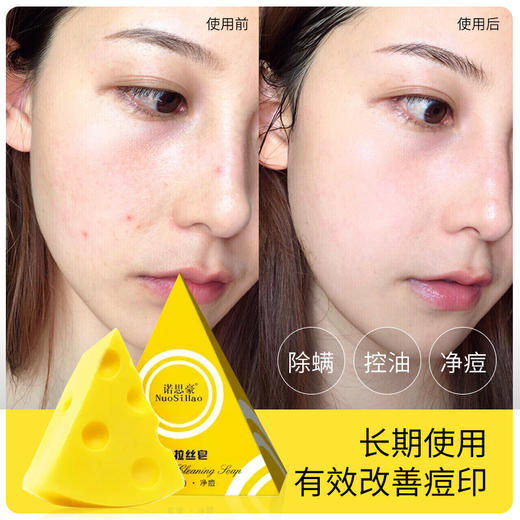 【买1送1，除螨祛痘】诺思豪网红海盐芝士拉丝皂、祛螨、控油、净痘 商品图1