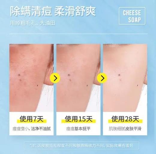 【买1送1，除螨祛痘】诺思豪网红海盐芝士拉丝皂、祛螨、控油、净痘 商品图4