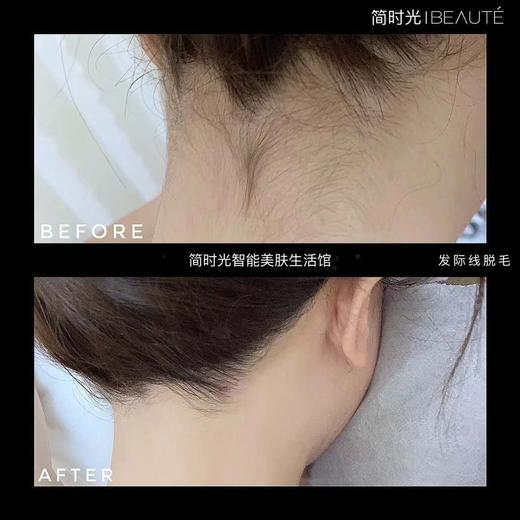 #简世光BEAUTE-精准护肤#【808半导体冷肤无痛脱毛】限时7折优惠 商品图4