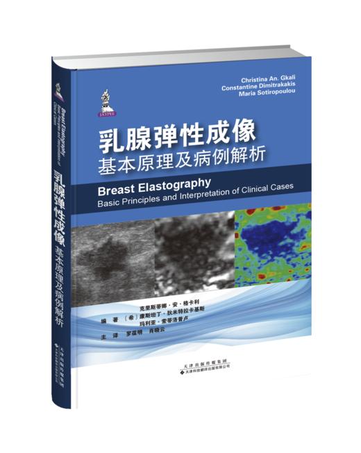 乳腺弹性成像基本原理及病例解析 商品图0