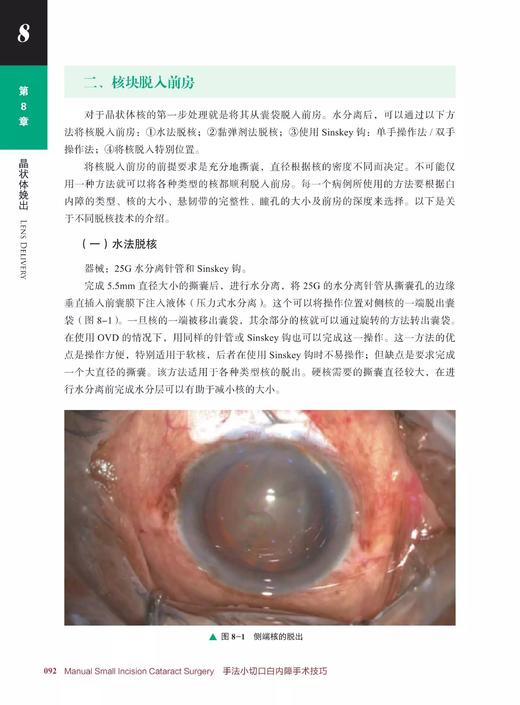 手法小切口白内障手术技巧  眼科外科书籍 眼科手术 大量高清手术图片及精美手绘图片 商品图5