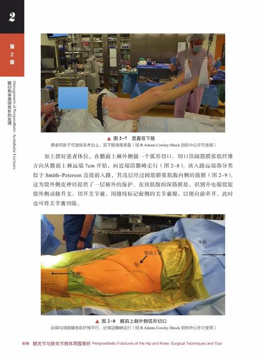 髋关节与膝关节假体周围骨折 引进自德国 Springer 出版社的一部关节外科学著作 外科学 骨科学 医学专著 商品图7