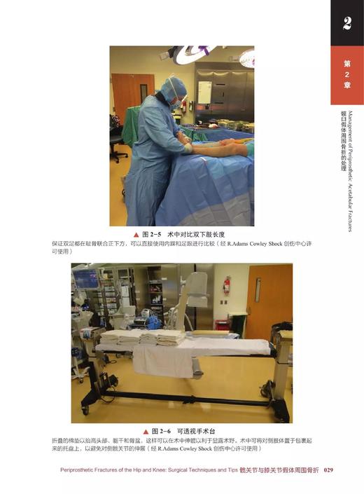 髋关节与膝关节假体周围骨折 引进自德国 Springer 出版社的一部关节外科学著作 外科学 骨科学 医学专著 商品图6