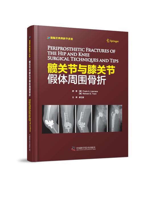 髋关节与膝关节假体周围骨折 引进自德国 Springer 出版社的一部关节外科学著作 外科学 骨科学 医学专著 商品图0
