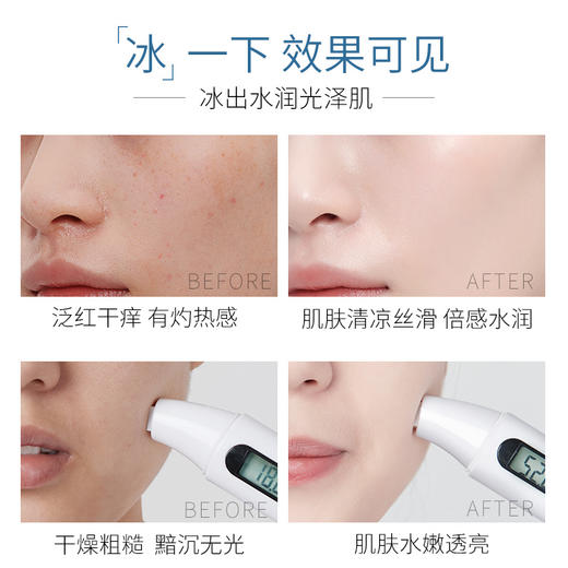 透蜜舒缓修护冰膜 商品图3