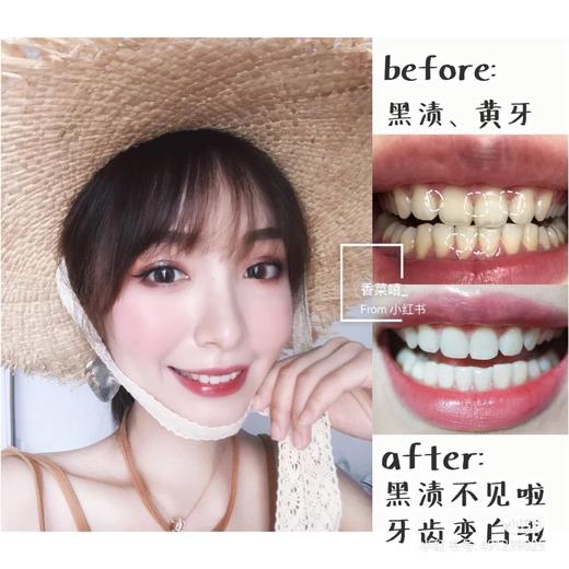 刷出一口健康大白牙！LION/狮王日本本土版white大白牙膏150g 亮白牙齿 去黄牙垢去牙烟渍 防蛀防龋齿 清新口气 除口臭 三支特价 每支仅19 商品图2