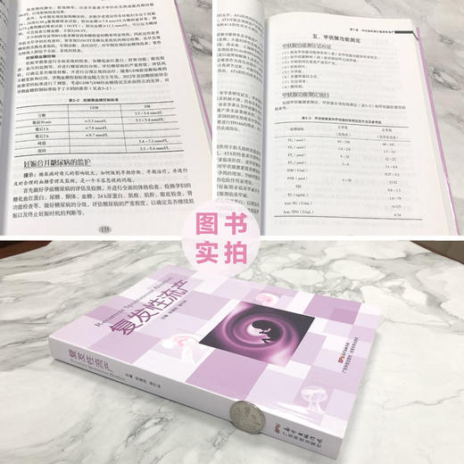 复发性流产 商品图2