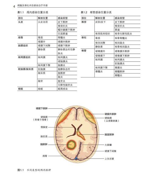 《颅脑及脊柱术后感染诊疗手册》 商品图1