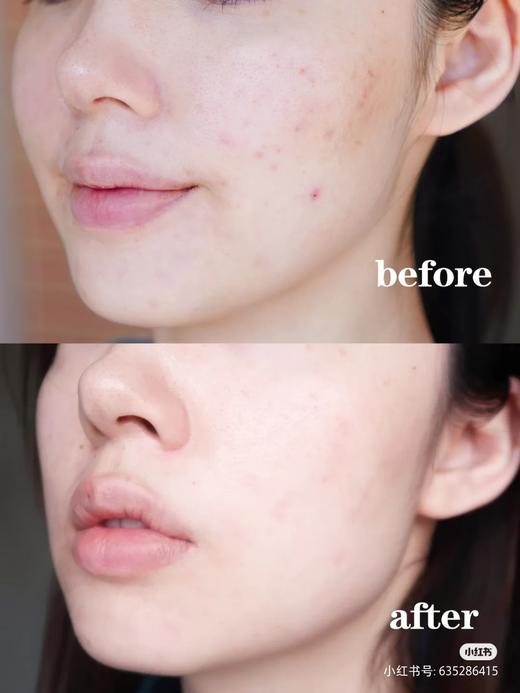 抗衰老必囤！雅诗兰黛ANR面部特润修护肌透小棕瓶精华露7ml 改善肌肤干燥缺水 肤色暗沉 皮肤松弛 人生必买的精华 4瓶包邮 商品图3