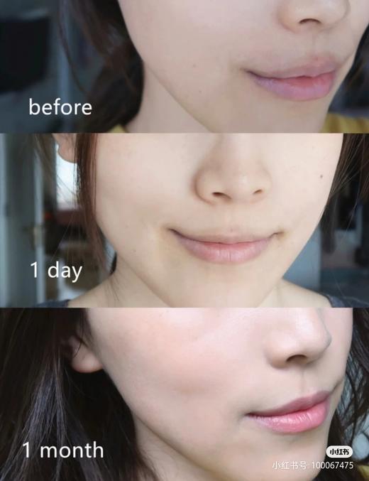 抗衰老必囤！雅诗兰黛ANR面部特润修护肌透小棕瓶精华露7ml 改善肌肤干燥缺水 肤色暗沉 皮肤松弛 人生必买的精华 4瓶包邮 商品图2