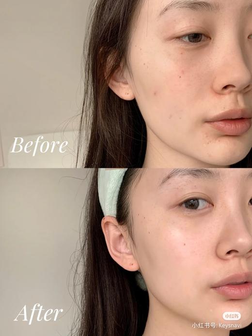 抗衰老必囤！雅诗兰黛ANR面部特润修护肌透小棕瓶精华露7ml 改善肌肤干燥缺水 肤色暗沉 皮肤松弛 人生必买的精华 4瓶包邮 商品图4