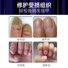 德国SOS牌指甲抑菌笔灰指甲笔固甲抑制菌液去除增厚净甲水4ml 商品缩略图2