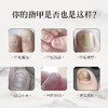 【械字号冷敷敷料】肌肤之食灰指甲膏——安全无痛，持久渗透 商品缩略图1