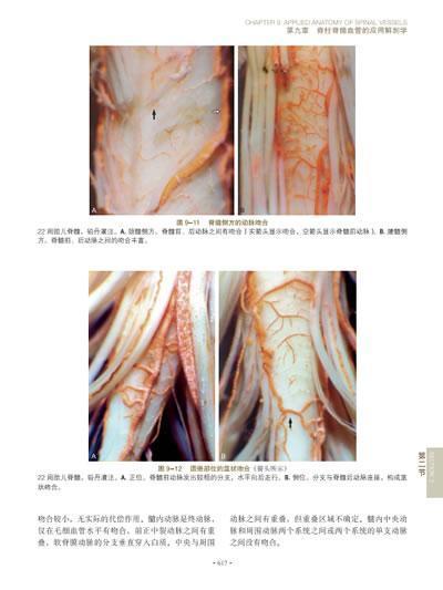 脑脊髓血管外科学 中国脑血管外科原创精品、我国神经外科界泰斗和神经外科开拓者的倾力奉献、神经外科的百科全书 商品图8