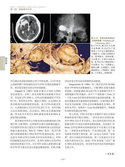 脑脊髓血管外科学 中国脑血管外科原创精品、我国神经外科界泰斗和神经外科开拓者的倾力奉献、神经外科的百科全书 商品图1