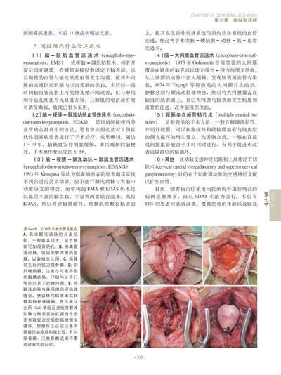 脑脊髓血管外科学 中国脑血管外科原创精品、我国神经外科界泰斗和神经外科开拓者的倾力奉献、神经外科的百科全书 商品图6