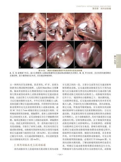 脑脊髓血管外科学 中国脑血管外科原创精品、我国神经外科界泰斗和神经外科开拓者的倾力奉献、神经外科的百科全书 商品图7