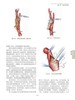 脑脊髓血管外科学 中国脑血管外科原创精品、我国神经外科界泰斗和神经外科开拓者的倾力奉献、神经外科的百科全书 商品缩略图11