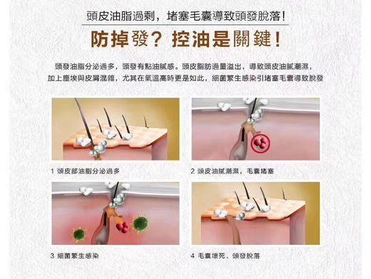 正品，400ml泰国atreus生姜洗发水
正品老姜王汁防脱无硅油控油止痒去头屑 商品图3