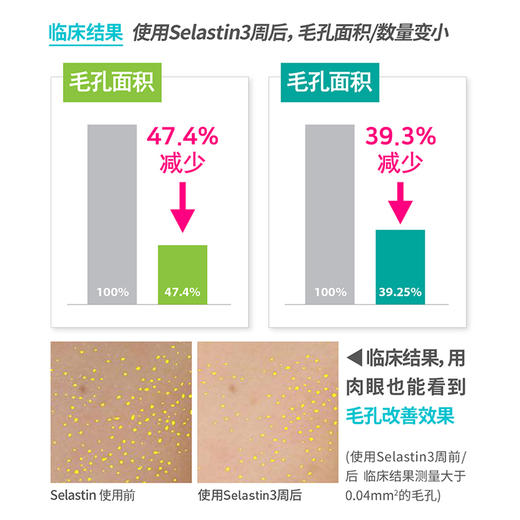 韩国SKINMISO十七蜜秀面部护理收缩毛孔控油韩国精华爽肤水套装 商品图5