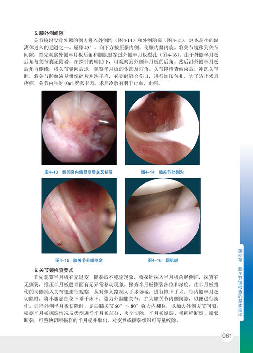 骨科精萃系列--实用关节镜手术学    主编：刘玉杰    化工出版 商品图5