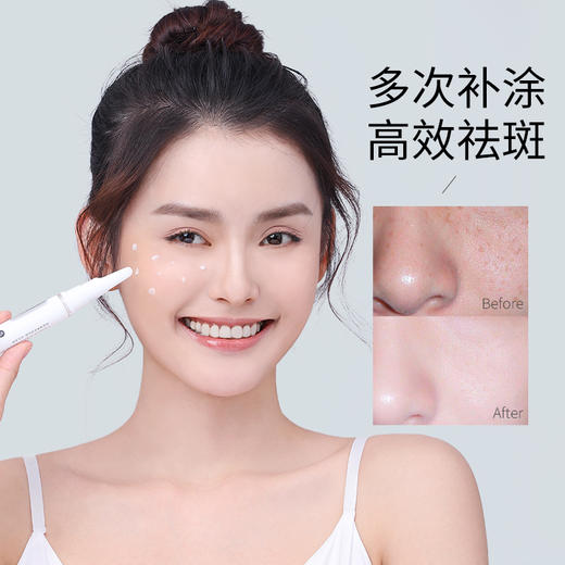 【精准淡斑，赠美白原液】泉兮祛斑笔——击退局部斑肌 商品图1