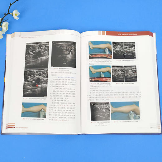 超声引导下的神经阻滞技术  9787313213549   商品图3