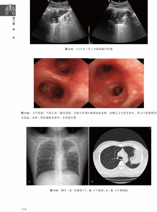 肺部疾病超声诊断临床解析 张骅 北医社 商品图3