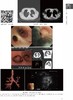 肺部疾病超声诊断临床解析 张骅 北医社 商品缩略图8