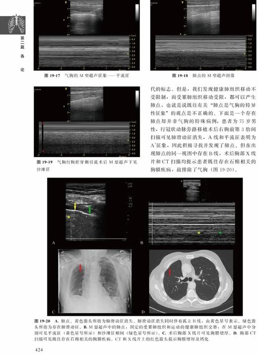 肺部疾病超声诊断临床解析 张骅 北医社 商品图7