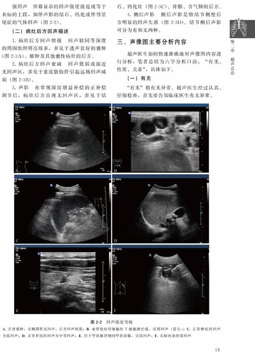 肺部疾病超声诊断临床解析 张骅 北医社 商品图2