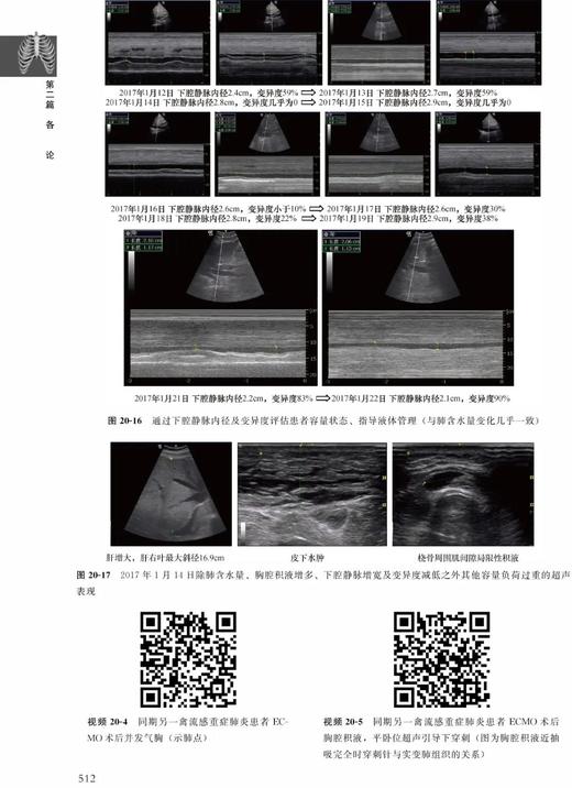 肺部疾病超声诊断临床解析 张骅 北医社 商品图9