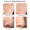 【碳酸泡泡，深层清洁】百肤欣晶透氧气碳酸面膜 商品缩略图3