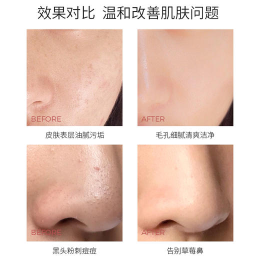 【碳酸泡泡，深层清洁】百肤欣晶透氧气碳酸面膜 商品图3