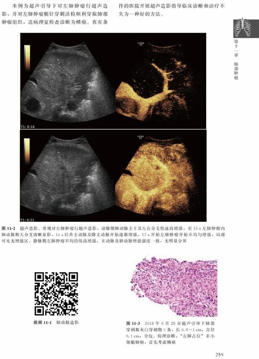 肺部疾病超声诊断临床解析 张骅 北医社 商品图4