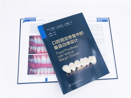 口腔固定修复中的垂直边缘设计 布鲁纳 口腔科学矫形外科学天然牙预备临时修复体制备技工咬合重建支架与底冠修复体黏固种植体基台 商品图2